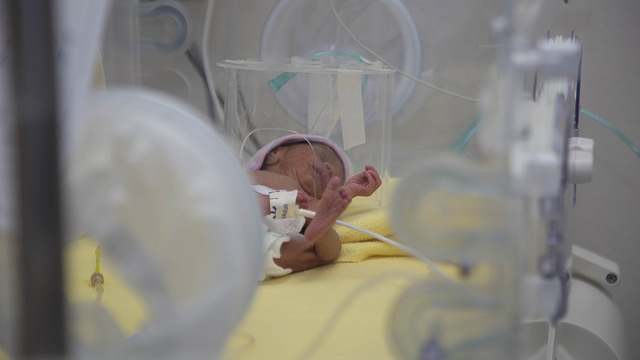 Dia mundial del bebe prematuro