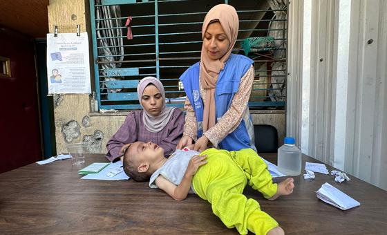 Uno de cada cinco niños en la ciudad de Gaza padece desnutrición grave