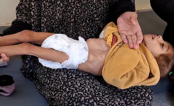 Desnutrición infantil en Gaza y situación de mujeres en Afganistán y Myanmar, entre las noticias del jueves