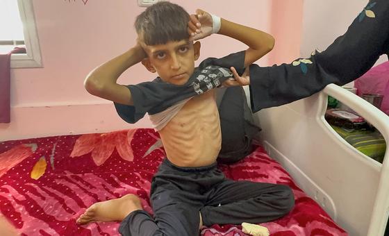 Mortalidad infantil en Gaza, violencia digital y vacuna contra la tosferina: noticias del martes