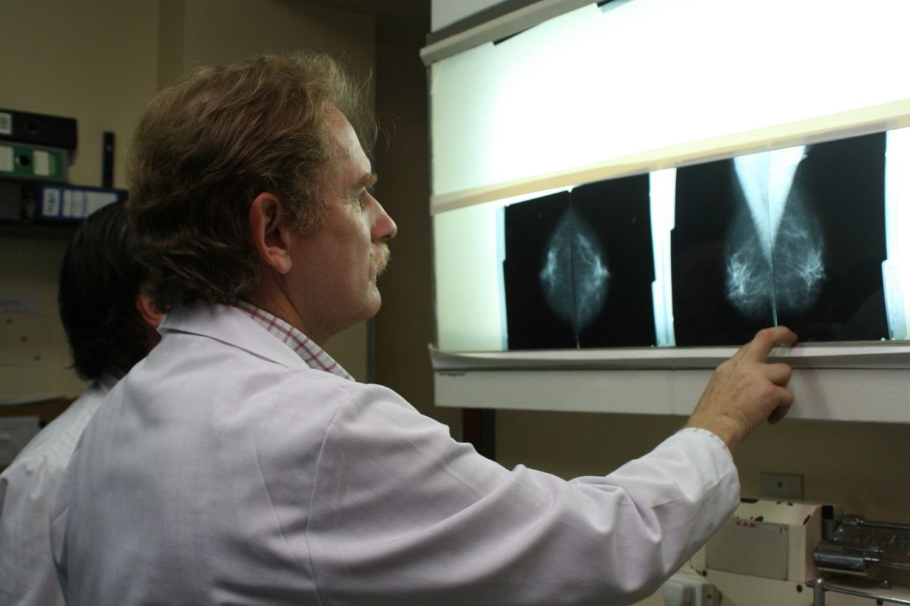 La mortalidad por cáncer de mama descendió 14% en la última década