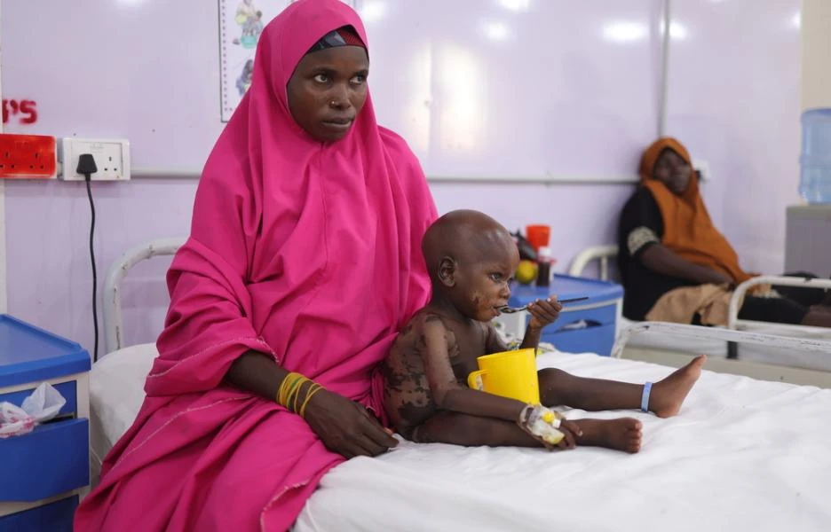 Nigeria: es necesario mantener y ampliar los avances en la lucha contra la desnutrición en Katsina